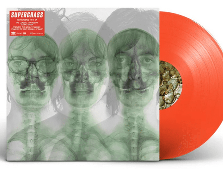 Supergrass